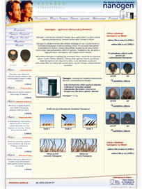 Wypadanie włosów, włosy, łysienie - Nanogen - gęstsze włosy